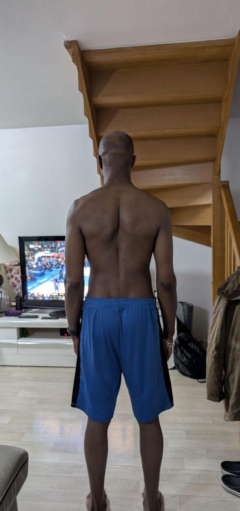 Moussa de dos, après 4 mois de suivi
