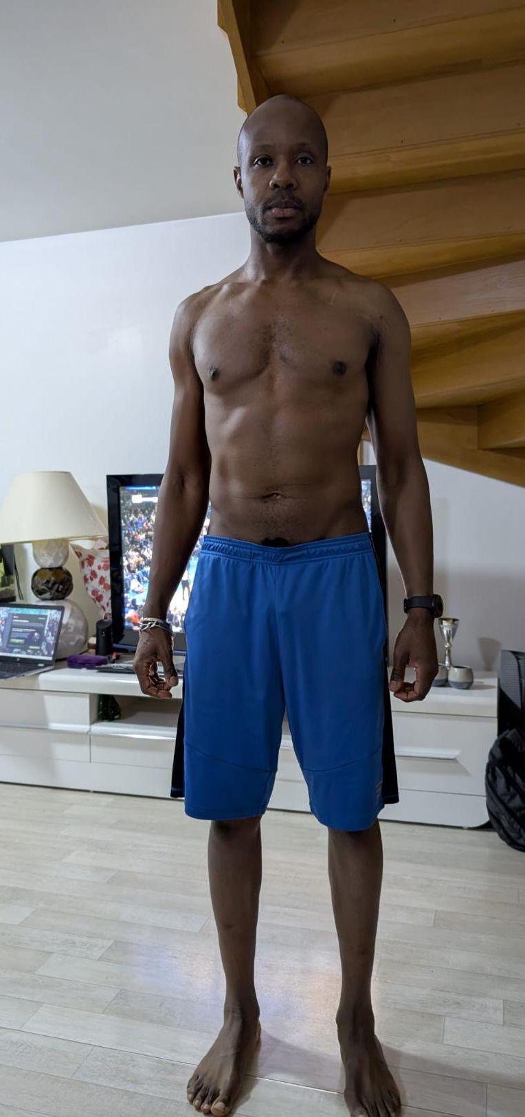 Moussa de face, après 4 mois de suivi